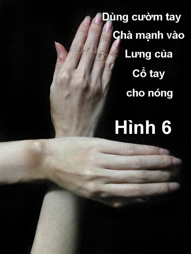 Chữa vẹo cổ